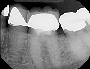 Read more about the article Dentaltown Publishes 70-Year Recall