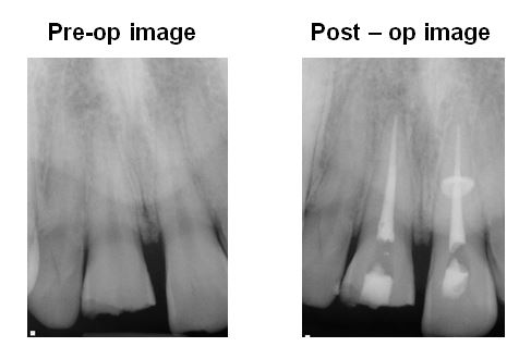 Pre and Post Op Images