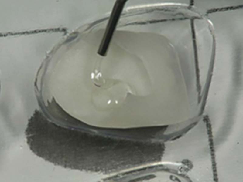 clinical-procedure2-kleer-veneer-7
